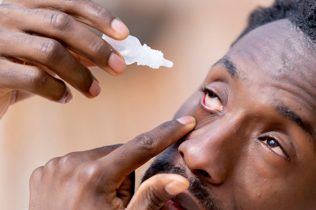 Close up of a black skinned man with dry eyes applying artificial tears in spring in a park